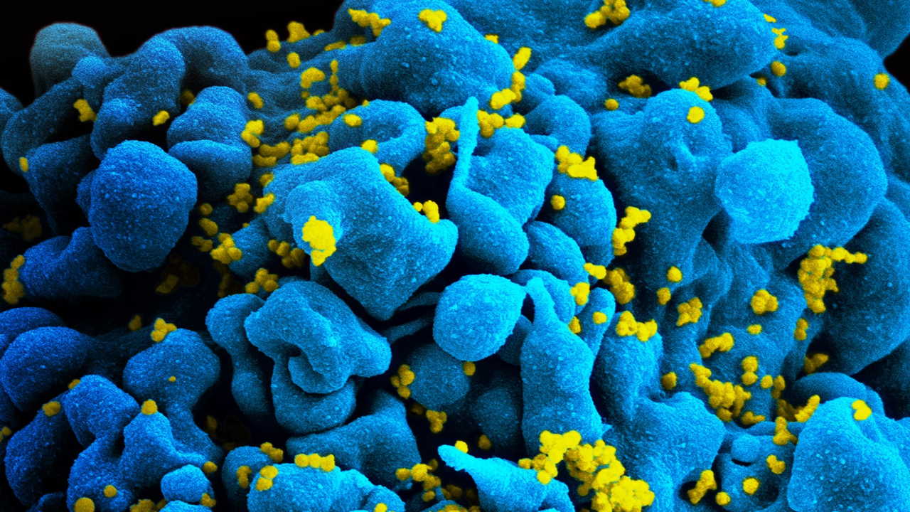 Технологію редагування генів CRISPR вперше вивчать для лікування ВІЛ