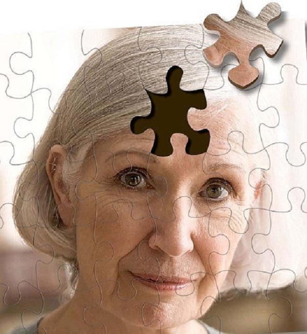 Виявлена головна причина хвороби Альцгеймера