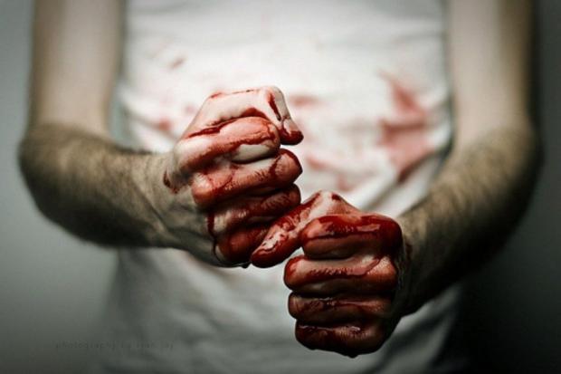 В Ужгороді жорстоко побили чоловіка, потерпілий у лікарні