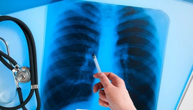 В Україні зареєстрували інноваційні ліки проти туберкульозу