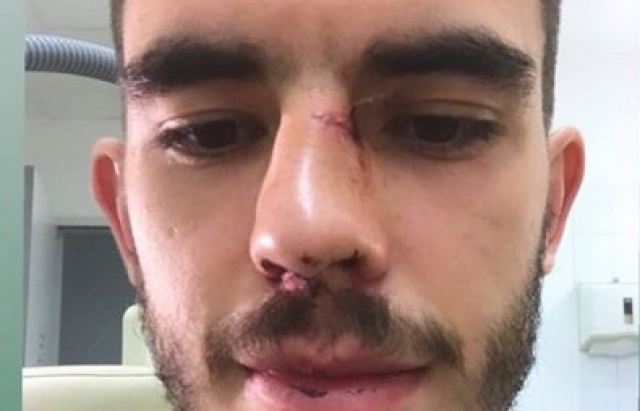 Мукачівський футболіст, що грає за угорський "Ференцварош", - серйозно травмувався під час матчу