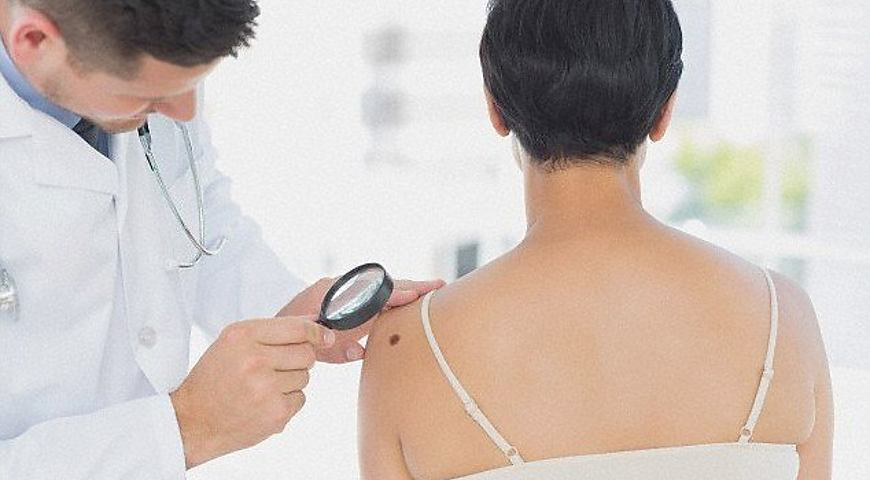 Онкологи назвали сім методів захисту від раку шкіри