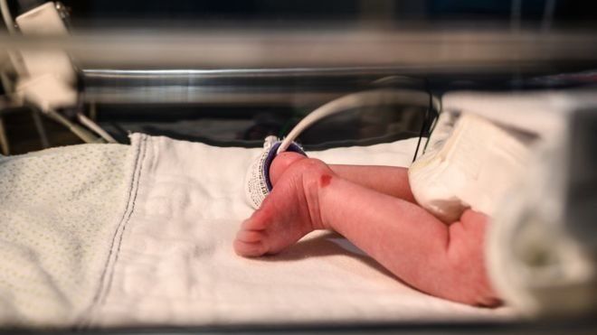 Малюка з рідкісним "синдромом вампіра" покинули в лікарні