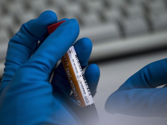 В Україні підтвердили 29 випадків зараження коронавірусом