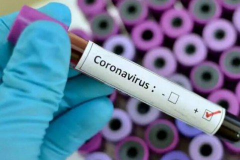 Ще три випадки захворювання коронавірусом підтвердили на Закарпатті (ДОКУМЕНТ)