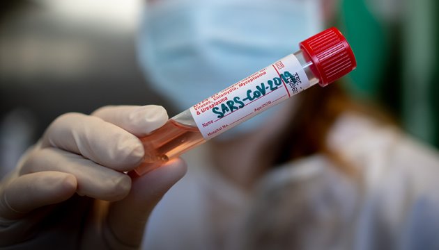 Медведчук: Влада має встановити реальну ситуацію для ефективної боротьби з епідемією коронавірусу: ми готові взяти на себе фінансування такого дослідження - Заява