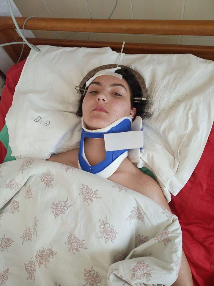 Дівчині, яка постраждала в жахливій аварії на Виноградівщині, потрібна допомога (ФОТО)