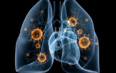 З початку року на Закарпатті виявлено 270 нових випадків та рецидивів туберкульозу