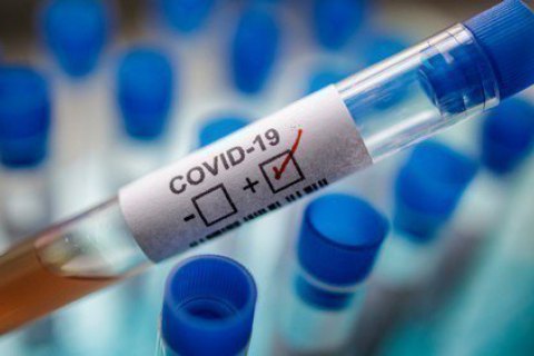 У світі зафіксували понад 5,8 млн випадків коронавірусу