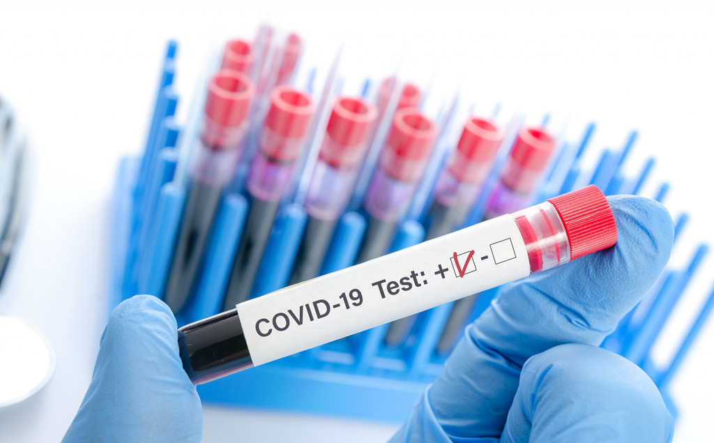 COVID-19 в Мукачеві: 96 ПЛР-тестів проведено за добу