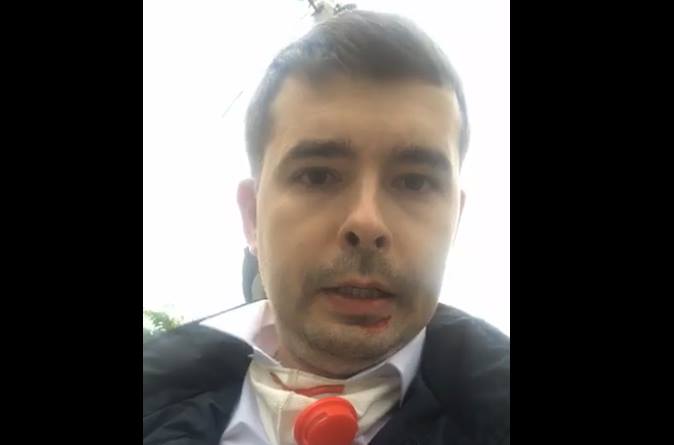 На відео зафіксували побиття кандидата в Ужгородську міську раду (ВІДЕО)