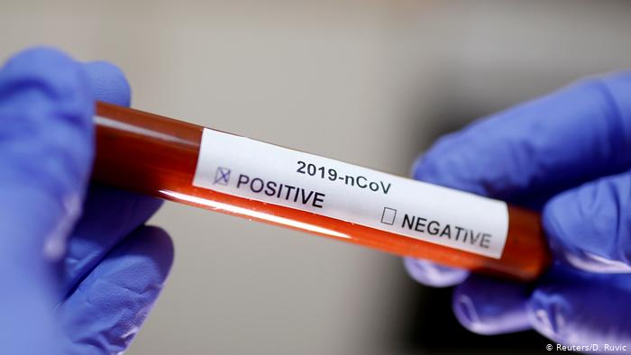 5 смертей за добу: коронавірус знову набирає обертів на Закарпатті