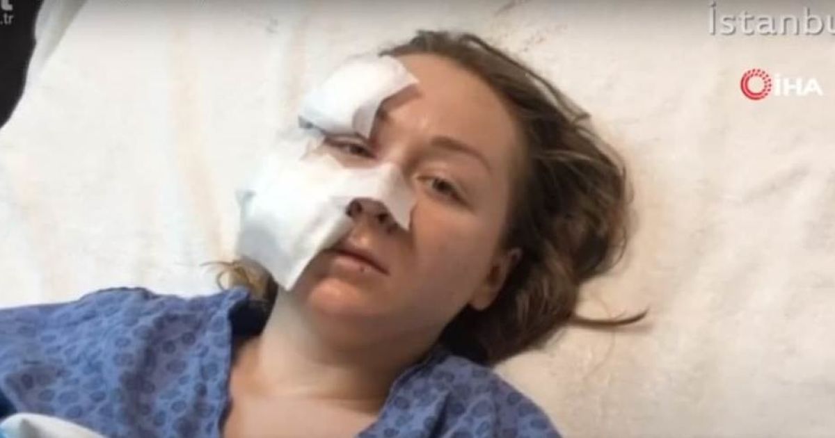 Напав з ножем у торговому центрі: у Туреччині чоловік порізав обличчя дружини-українки (ВІДЕО)