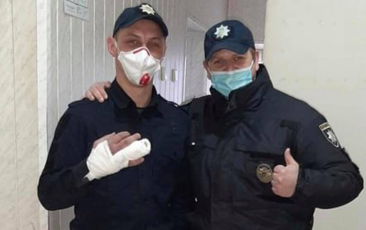 Карколомне затримання: в Ужгороді травмувався поліцейський під час погоні за крадієм (ФОТО)